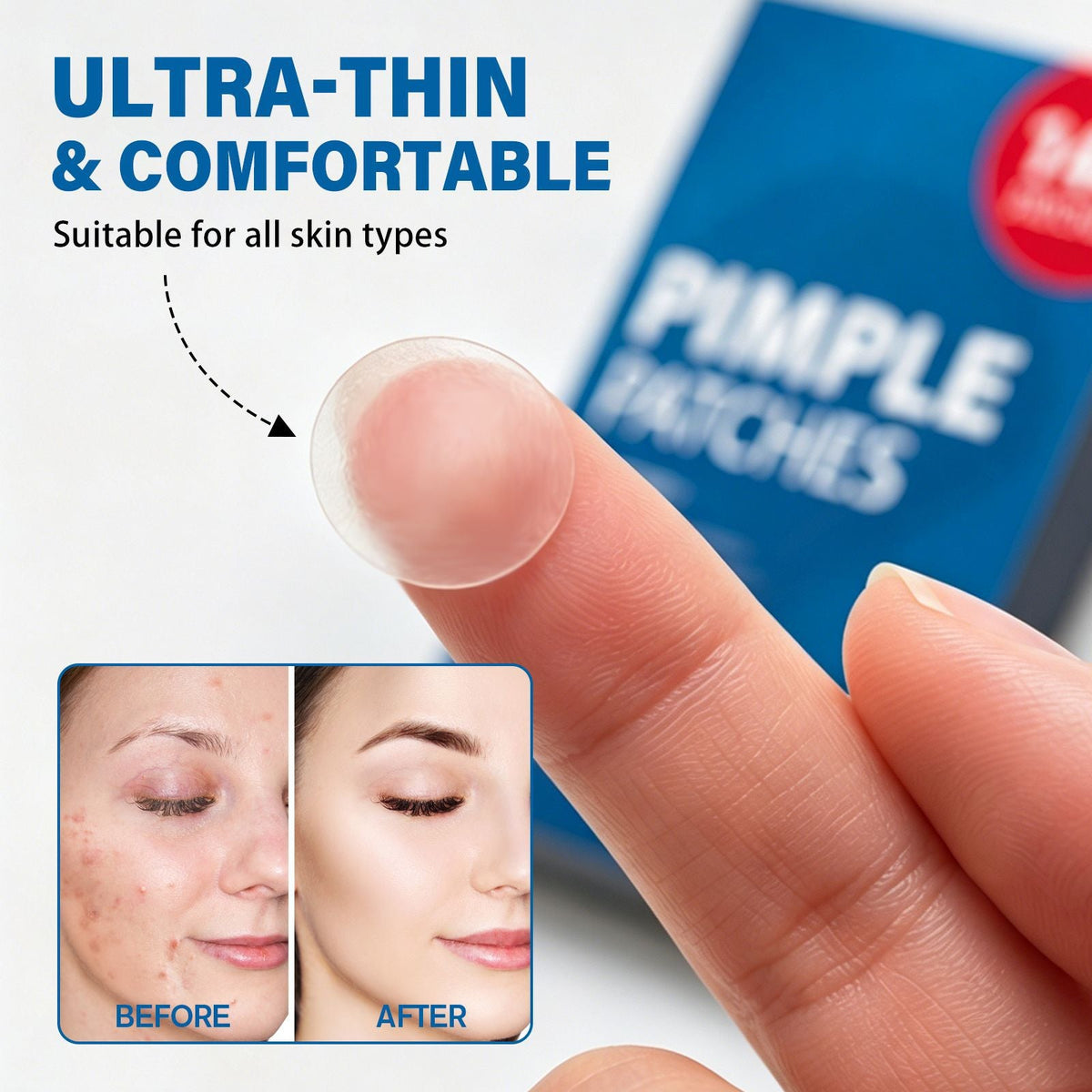 Invisible Pimple Stickers to Cover Acne Facial Care - Neednest